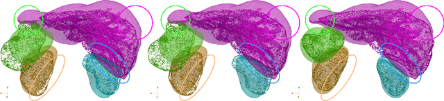 Figure 3 for A multi-organ point cloud registration algorithm for abdominal CT registration