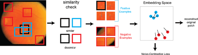 Figure 1 for CUTS: A Fully Unsupervised Framework for Medical Image Segmentation
