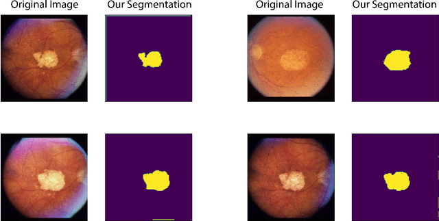Figure 3 for CUTS: A Fully Unsupervised Framework for Medical Image Segmentation