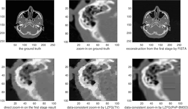 Figure 2 for Data-Consistent Local Superresolution for Medical Imaging