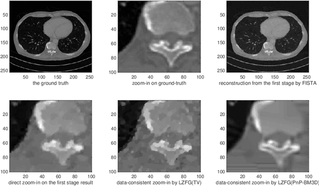 Figure 3 for Data-Consistent Local Superresolution for Medical Imaging
