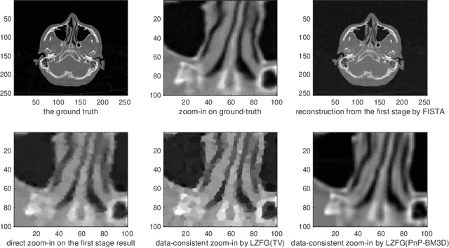 Figure 4 for Data-Consistent Local Superresolution for Medical Imaging
