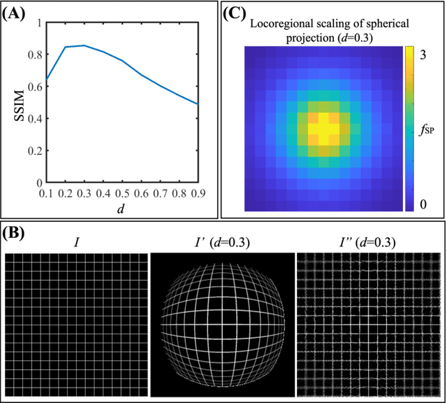 Figure 4 for Quantifying U-Net Uncertainty in Multi-Parametric MRI-based Glioma Segmentation by Spherical Image Projection