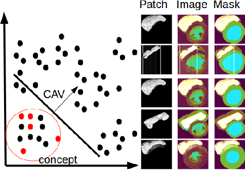 Figure 4 for Interpretability of a Deep Learning Model in the Application of Cardiac MRI Segmentation with an ACDC Challenge Dataset