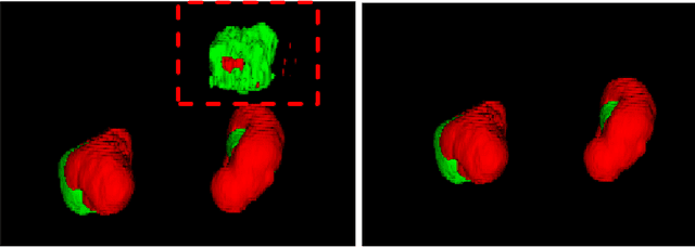 Figure 2 for Multi Scale Supervised 3D U-Net for Kidney and Tumor Segmentation