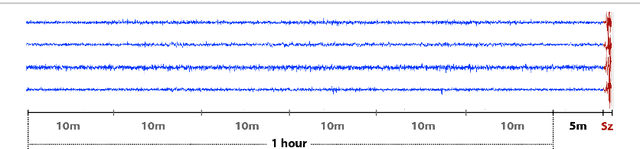 Figure 1 for Seizure Prediction Using Bidirectional LSTM