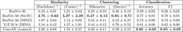 Figure 2 for Self-supervised learning for analysis of temporal and morphological drug effects in cancer cell imaging data