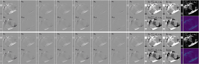 Figure 3 for Convolutional Dictionary Learning by End-To-End Training of Iterative Neural Networks