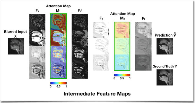 Figure 3 for Attention-gated convolutional neural networks for off-resonance correction of spiral real-time MRI