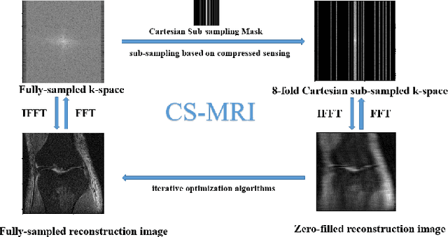 Figure 1 for Neural Architecture Search for Compressed Sensing Magnetic Resonance Image Reconstruction