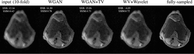 Figure 2 for Wasserstein GANs for MR Imaging: from Paired to Unpaired Training