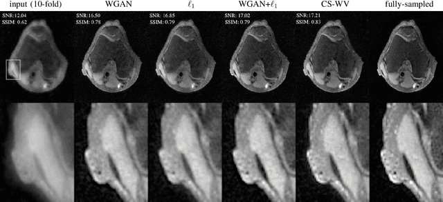 Figure 3 for Wasserstein GANs for MR Imaging: from Paired to Unpaired Training