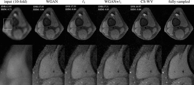 Figure 4 for Wasserstein GANs for MR Imaging: from Paired to Unpaired Training