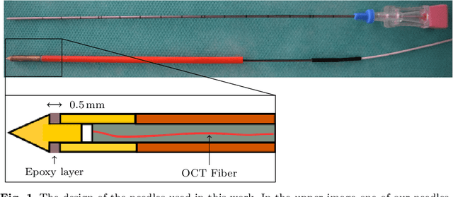 Figure 1 for Needle tip force estimation by deep learning from raw spectral OCT data