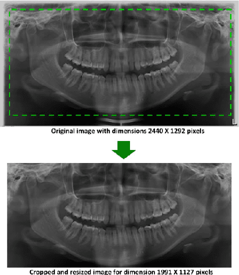 Figure 4 for Automatic segmenting teeth in X-ray images: Trends, a novel data set, benchmarking and future perspectives