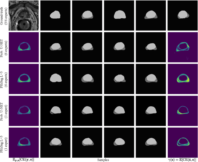 Figure 4 for PHiSeg: Capturing Uncertainty in Medical Image Segmentation