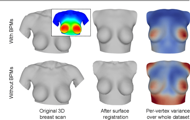 Figure 4 for Learning the shape of female breasts: an open-access 3D statistical shape model of the female breast built from 110 breast scans