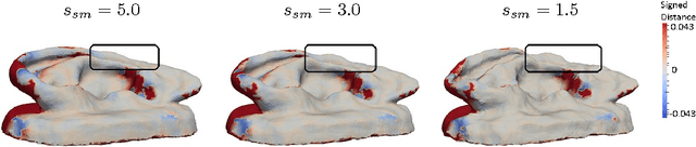 Figure 4 for Finite Element Based Tracking of Deforming Surfaces