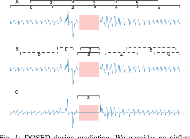 Figure 1 for AI vs Humans for the diagnosis of sleep apnea