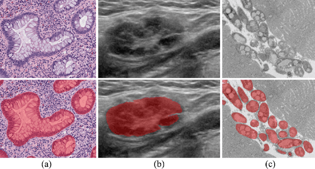 Figure 1 for BoxNet: Deep Learning Based Biomedical Image Segmentation Using Boxes Only Annotation