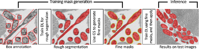 Figure 3 for BoxNet: Deep Learning Based Biomedical Image Segmentation Using Boxes Only Annotation