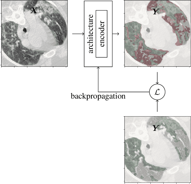 Figure 1 for Comprehensive Comparison of Deep Learning Models for Lung and COVID-19 Lesion Segmentation in CT scans