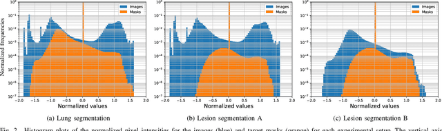 Figure 2 for Comprehensive Comparison of Deep Learning Models for Lung and COVID-19 Lesion Segmentation in CT scans