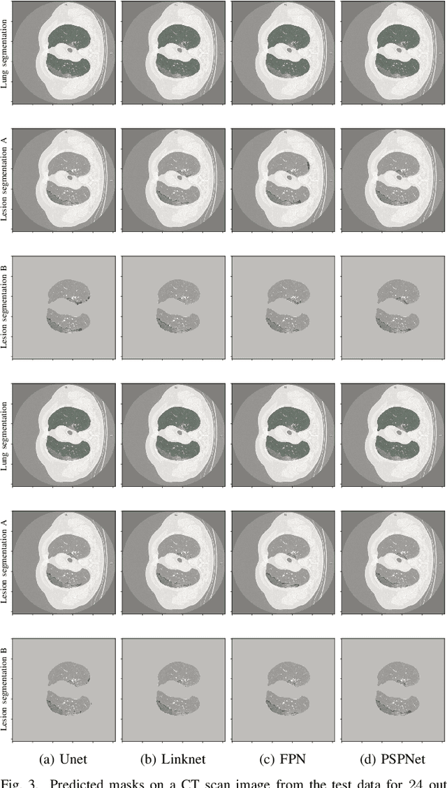 Figure 3 for Comprehensive Comparison of Deep Learning Models for Lung and COVID-19 Lesion Segmentation in CT scans