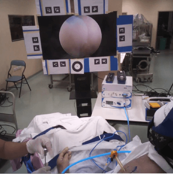 Figure 1 for Differentiating Surgeon Expertise Solely by Eye Movement Features