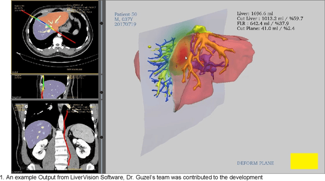 Figure 1 for Automatic Liver Segmentation from CT Images Using Deep Learning Algorithms: A Comparative Study