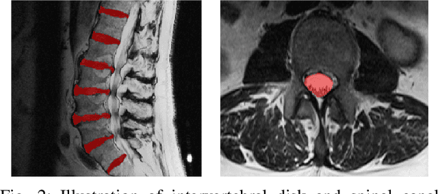 Figure 2 for EigenRank by Committee: A Data Subset Selection and Failure Prediction paradigm for Robust Deep Learning based Medical Image Segmentation