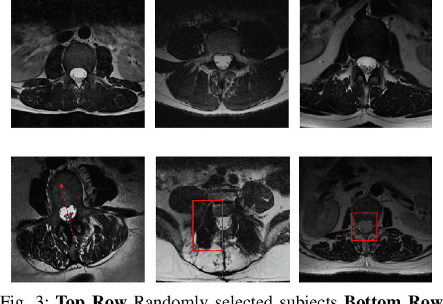 Figure 3 for EigenRank by Committee: A Data Subset Selection and Failure Prediction paradigm for Robust Deep Learning based Medical Image Segmentation