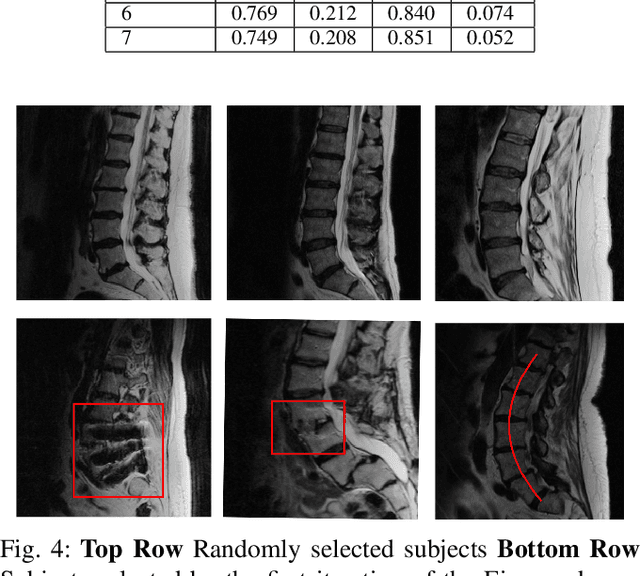 Figure 4 for EigenRank by Committee: A Data Subset Selection and Failure Prediction paradigm for Robust Deep Learning based Medical Image Segmentation