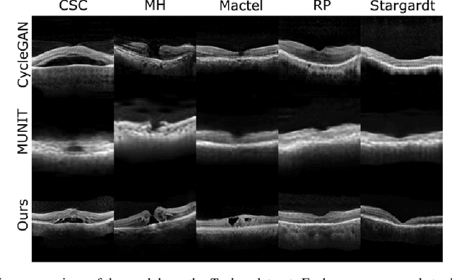 Figure 3 for Unsupervised Image to Image Translation for Multiple Retinal Pathology Synthesis in Optical Coherence Tomography Scans