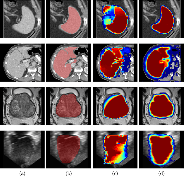 Figure 3 for Weakly supervised segmentation from extreme points