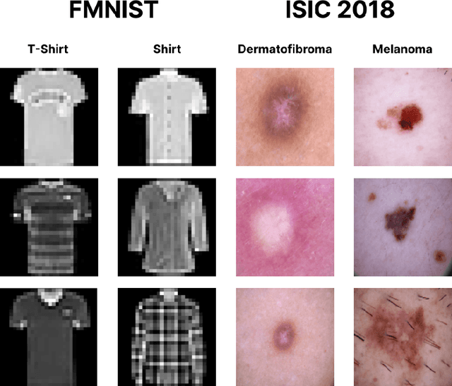 Figure 4 for An Asymmetric Contrastive Loss for Handling Imbalanced Datasets