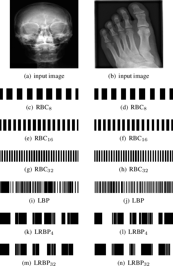 Figure 3 for Barcode Annotations for Medical Image Retrieval: A Preliminary Investigation