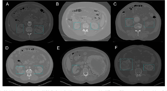 Figure 1 for Kidney Recognition in CT Using YOLOv3