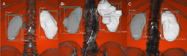 Figure 3 for Kidney Recognition in CT Using YOLOv3