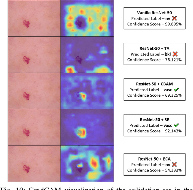 Figure 2 for Assessing the Impact of Attention and Self-Attention Mechanisms on the Classification of Skin Lesions