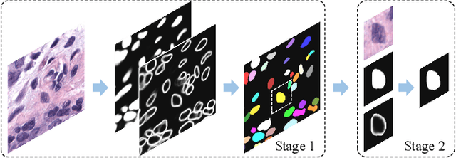 Figure 4 for Boundary-assisted Region Proposal Networks for Nucleus Segmentation