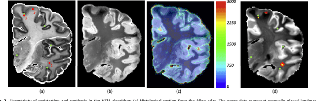 Figure 3 for Joint registration and synthesis using a probabilistic model for alignment of MRI and histological sections