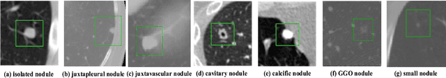 Figure 1 for U-Det: A Modified U-Net architecture with bidirectional feature network for lung nodule segmentation