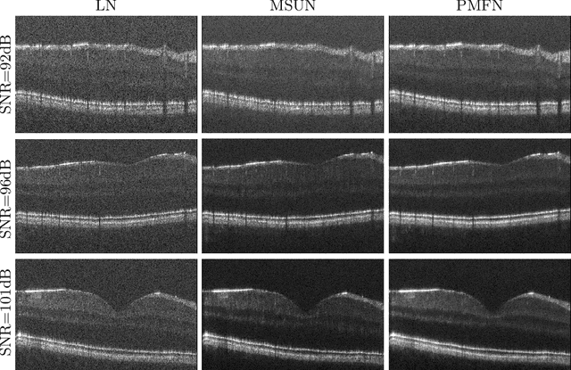 Figure 4 for Retinal OCT Denoising with Pseudo-Multimodal Fusion Network