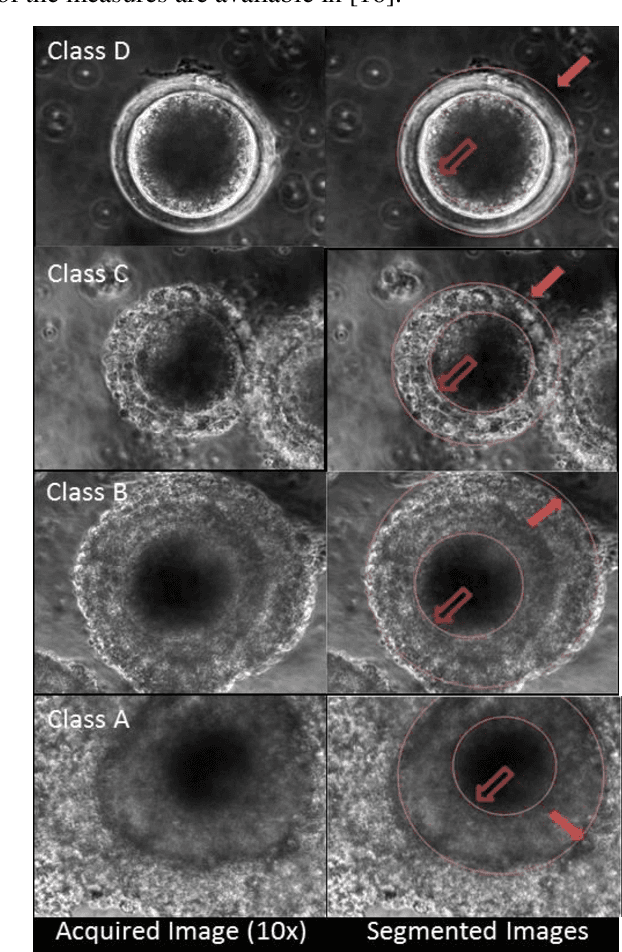 Figure 2 for Grading of Mammalian Cumulus Oocyte Complexes using Machine Learning for in Vitro Embryo Culture