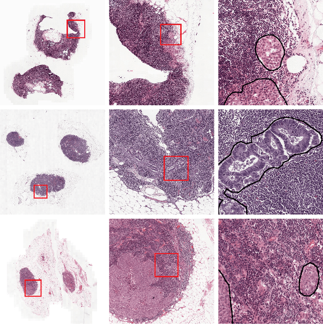 Figure 2 for Domain adaptation strategies for cancer-independent detection of lymph node metastases
