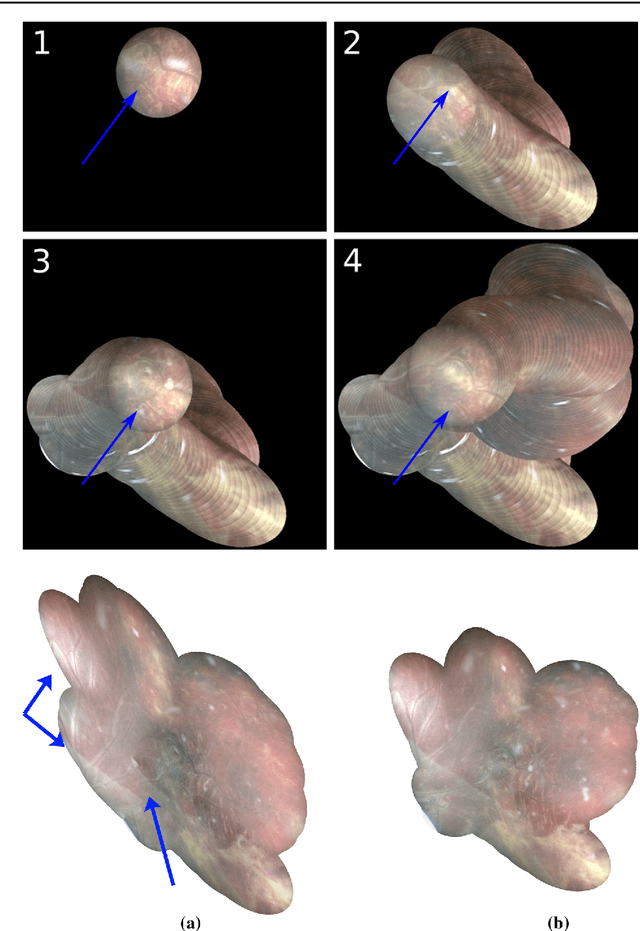 Figure 4 for Retrieval and Registration of Long-Range Overlapping Frames for Scalable Mosaicking of In Vivo Fetoscopy
