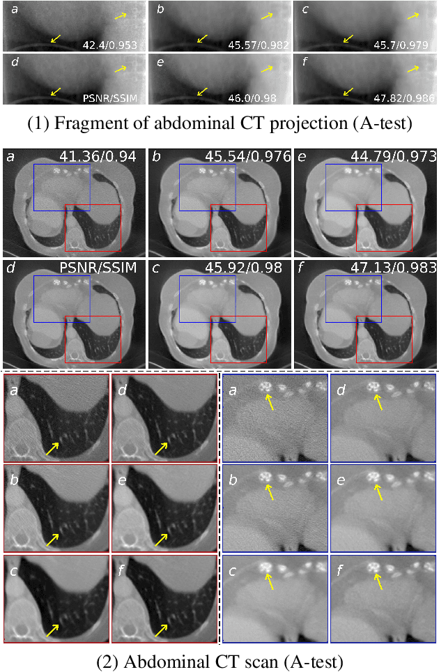 Figure 3 for No-reference denoising of low-dose CT projections
