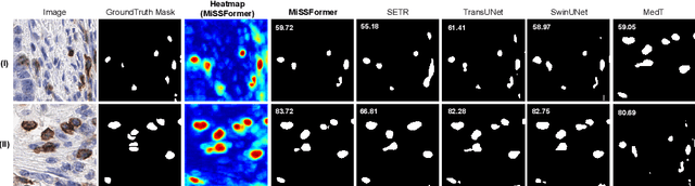 Figure 3 for ICOS Protein Expression Segmentation: Can Transformer Networks Give Better Results?