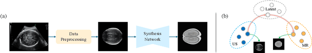 Figure 1 for Anatomy-Aware Self-supervised Fetal MRI Synthesis from Unpaired Ultrasound Images